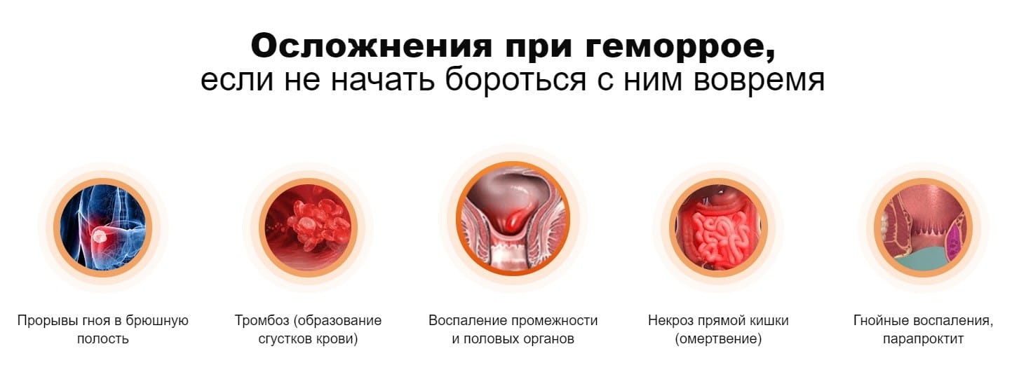 Почему После Анального Секса